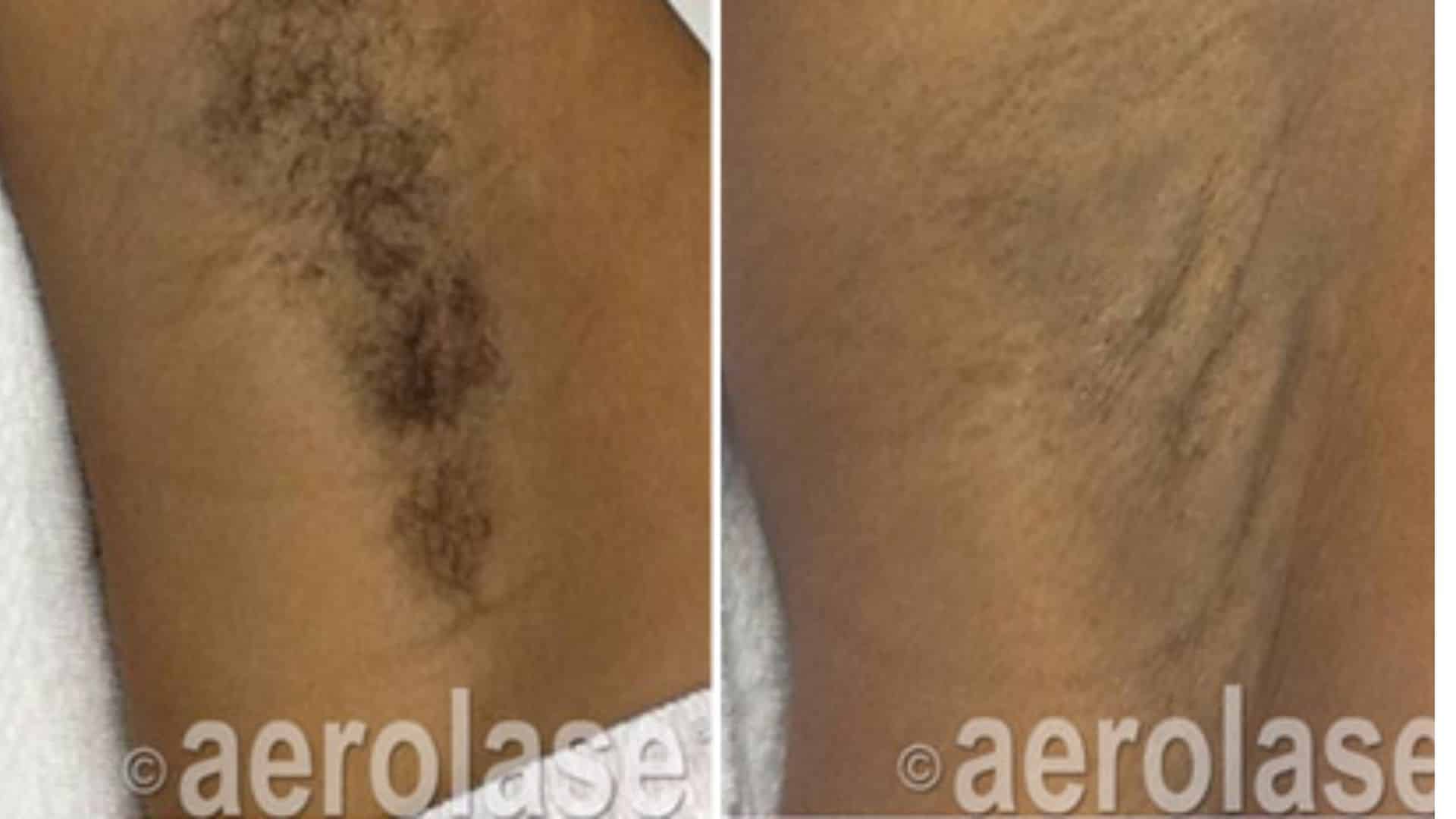 before and after hair treatment